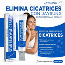 Scar Removal Cream™ – Crema Avanzada para la Eliminacion de Marcas y Cicatrices
